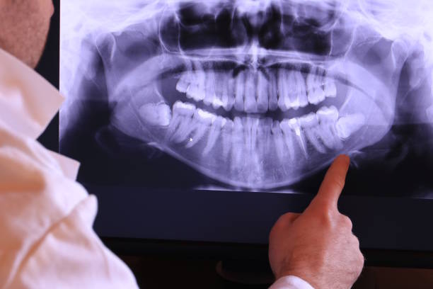 Best Emergency Tooth Extraction in Columbia, KY