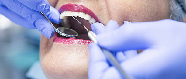 Best Emergency Dental Care for Broken or Chipped Teeth in Columbia, KY